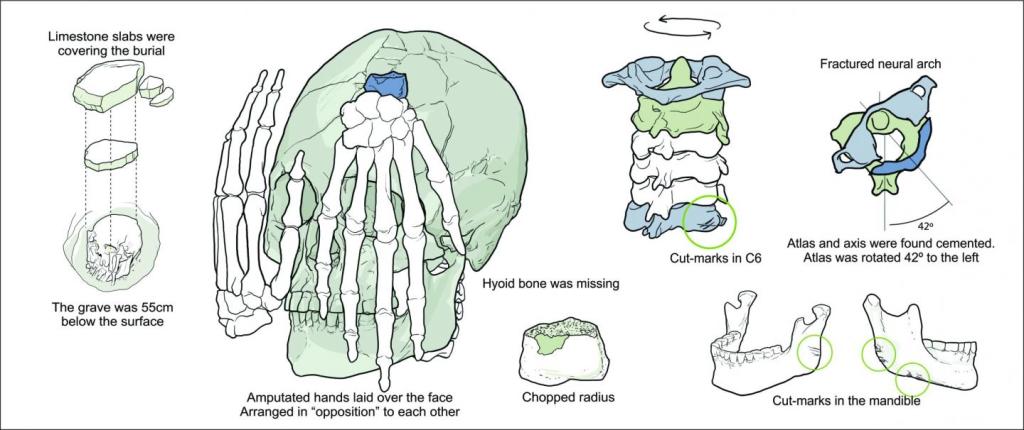 An illustration showing the arrangement of the amputated hands on the skull, and the locations of V-shaped marks. (Drawing by Gil Tokyo)