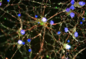 Imaging studies showed C4 (in green) located at the synapses of primary human neurons. (Image credit: Image courtesy of Heather de Rivera [McCarroll lab]) 