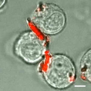 Monocytes — a kind of white blood cell — carrying drug-loaded backpacks (red). (The scale bar is 5 µm.) (Image credit: Roberta Polak & Rosanna Lim)