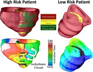 3D heart models