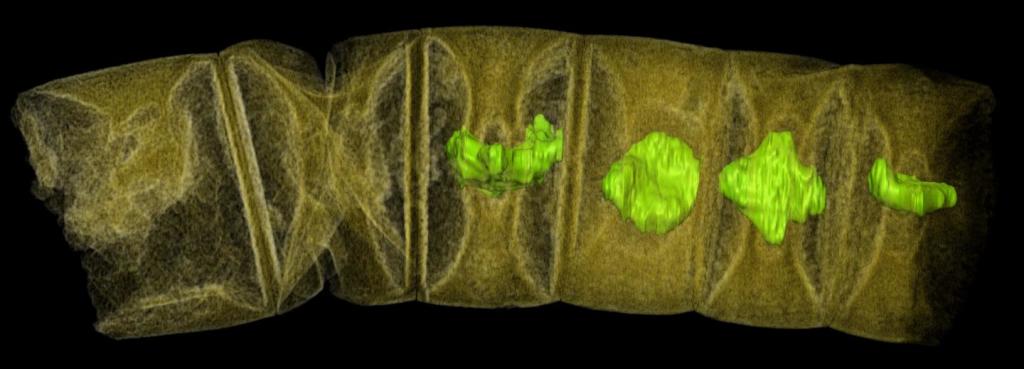 X-ray tomographic picture (false colors) of fossil thread-like red algae. (Image by Stefan Bengtson)