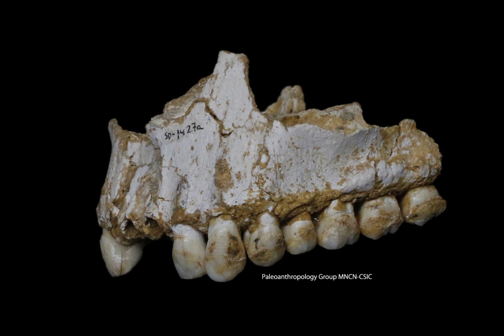 Plaque deposit is visible on the rear molar (right) of this Neandertal. (Image by Paleoanthropology Group MNCN-CSIC)