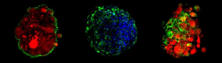 Blood-brain-barrier spheroids present high level of efflux pump (left: green) and tight junctions (center and right: green) on the surface of each spheroid to keep foreign molecules out. CREDIT (Image courtesy of Choi-Fong Cho, Brigham and Women's Hospital)