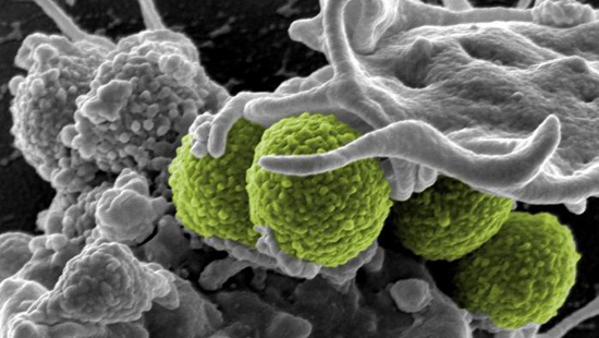 Staphylococcus aureus bacteria (colored green) interacting with a human immune cell. This study shows that in conditions like toxic shock syndrome, toxins from such bacteria can trigger one type of immune cells (MAIT cells) to turn against the host. (Image via NIAID)